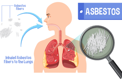 Things to Consider Before Filing an Asbestos Lawsuit